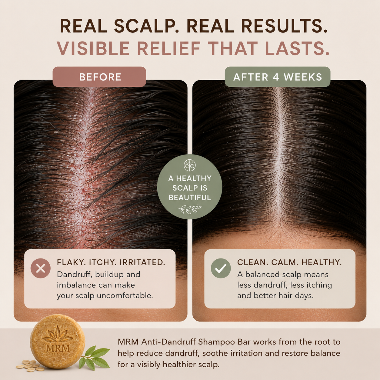 an irritated scalp verses a healthy scalp